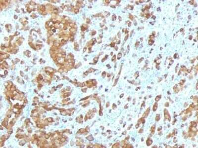 Immunohistochemistry-Paraffin: Melan-A/MART-1 Antibody (MLANA/788) - Azide and BSA Free [NBP2-47803]