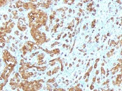 Immunohistochemistry-Paraffin: Melan-A/MART-1 Antibody (MLANA/788) [NBP2-44394]