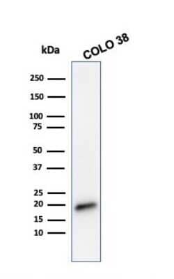 Western Blot: Melan-A/MART-1 Antibody (MLANA/788) [NBP2-44394]