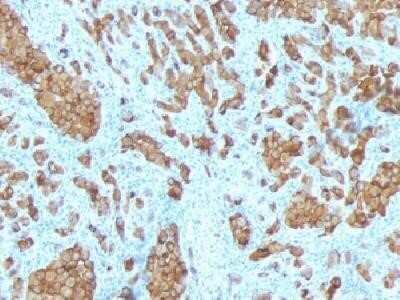 Immunohistochemistry-Paraffin: Melan-A/MART-1 Antibody (SPM342) - Azide and BSA Free [NBP2-34765]