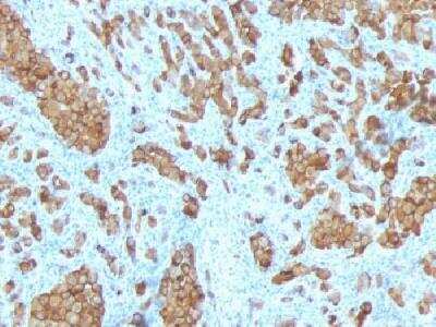 Immunohistochemistry-Paraffin: Melan-A/MART-1 Antibody (SPM342) [NBP2-32976]