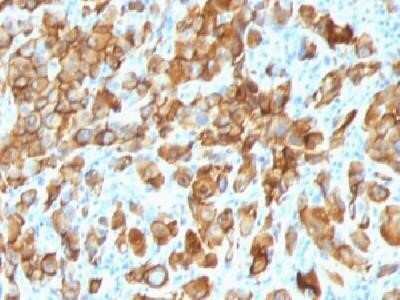 Immunohistochemistry-Paraffin: Melan-A/MART-1 Antibody (SPM540) - Azide and BSA Free [NBP2-34786]