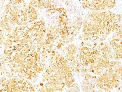 Immunohistochemistry-Paraffin: Melan-A/MART-1 Antibody (SPM540) - Azide and BSA Free [NBP2-34786]