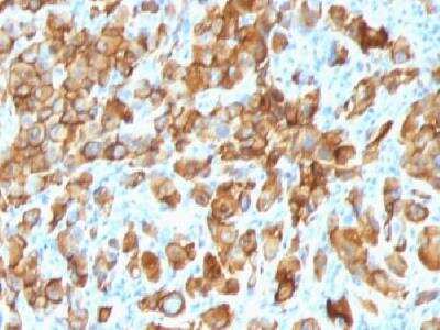 Immunohistochemistry-Paraffin: Melan-A/MART-1 Antibody (SPM540) [NBP2-32977]