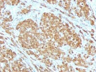 Immunohistochemistry-Paraffin: Melan-A/MART-1 Antibody (SPM555) - Azide and BSA Free [NBP2-34797]