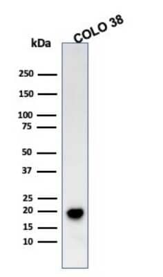 Western Blot: Melan-A/MART-1 Antibody (SPM555)Azide and BSA Free [NBP2-34797]