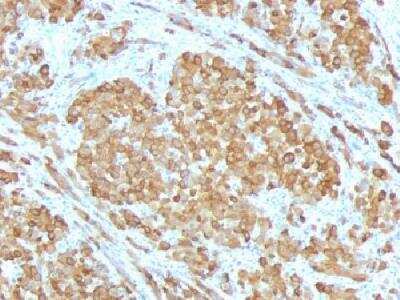 Immunohistochemistry-Paraffin: Melan-A/MART-1 Antibody (SPM555) [NBP2-32979]