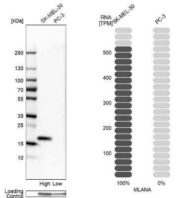 Western Blot: Melan-A/MART-1 Antibody [NBP2-33535]