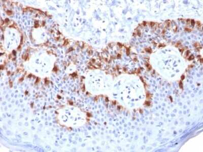 Immunohistochemistry-Paraffin: Melan-A/MART-1 Antibody (rMLANA/788) [NBP2-53293]