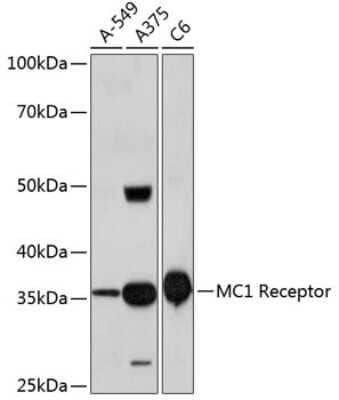 Western Blot: Melanocortin-1 R/MC1R Antibody (6D1S5) [NBP3-15409]