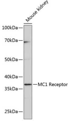 Western Blot: Melanocortin-1 R/MC1R Antibody (6D1S5) [NBP3-15409]