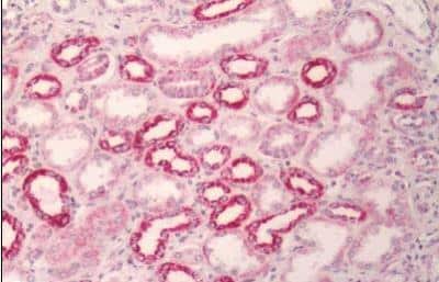 Immunohistochemistry-Paraffin: Melanocortin-1 R/MC1R Antibody - BSA Free [NLS1040]