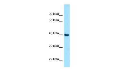 Western Blot: Melanocortin-1 R/MC1R Antibody [NBP2-84156]