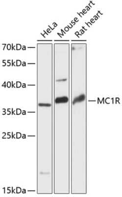 Western Blot: Melanocortin-1 R/MC1R AntibodyAzide and BSA Free [NBP3-02970]