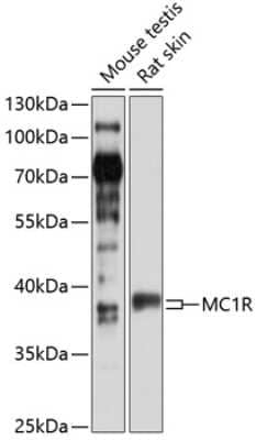 Western Blot: Melanocortin-1 R/MC1R AntibodyBSA Free [NBP3-03527]