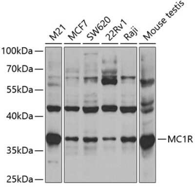 Western Blot: Melanocortin-1 R/MC1R AntibodyBSA Free [NBP3-03858]