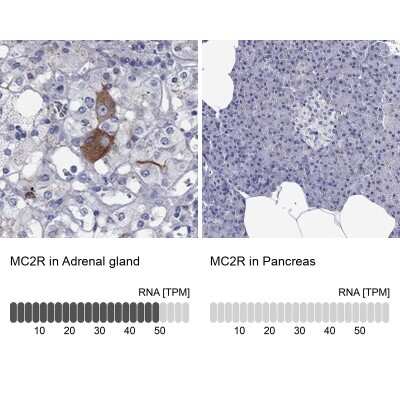 Immunohistochemistry-Paraffin: Melanocortin-2 R/MC2R Antibody [NBP3-17107]