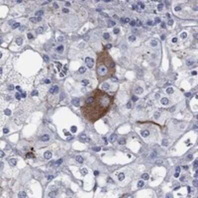 Immunohistochemistry-Paraffin: Melanocortin-2 R/MC2R Antibody [NBP3-17107]