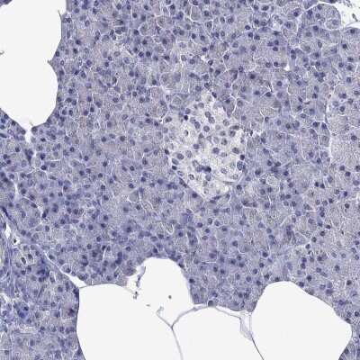 Immunohistochemistry-Paraffin: Melanocortin-2 R/MC2R Antibody [NBP3-17107]