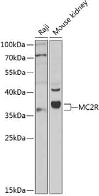 Western Blot: Melanocortin-2 R/MC2R AntibodyAzide and BSA Free [NBP3-03859]