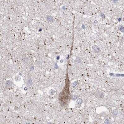 Immunohistochemistry-Paraffin: Melanocortin-3 R/MC3R Antibody [NBP3-17738]