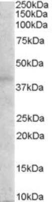 Western Blot: Melanocortin-3 R/MC3R Antibody [NB100-1501]