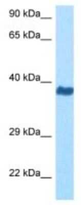 Western Blot: Melanocortin-3 R/MC3R Antibody [NBP3-10027]