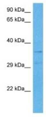 Western Blot: Melanocortin-3 R/MC3R Antibody [NBP3-10029]