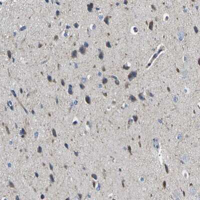 Immunohistochemistry-Paraffin: Melanocortin-4 R Antibody [NBP1-87567]