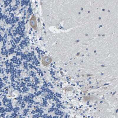 Immunohistochemistry-Paraffin: Melanocortin-4 R Antibody [NBP1-87567]