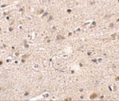 Immunohistochemistry-Paraffin: Melanocortin-4 R Antibody - BSA Free [NBP2-41103]