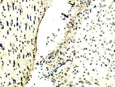 Immunohistochemistry-Paraffin: Melanocortin-4 R Antibody [NBP3-12325]