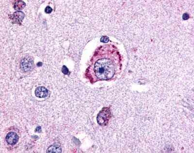 Immunohistochemistry-Paraffin: Melanocortin-4 R Antibody - BSA Free [NLS4165]