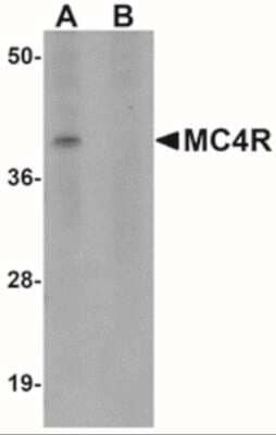 Western Blot: Melanocortin-4 R AntibodyBSA Free [NBP2-41103]