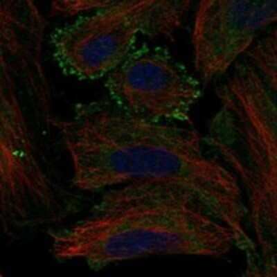 Immunocytochemistry/ Immunofluorescence: Melanocortin-5 R/MC5R Antibody [NBP3-17890]