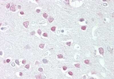 Immunohistochemistry-Paraffin: Melanocortin-5 R/MC5R Antibody [NBP1-36971]
