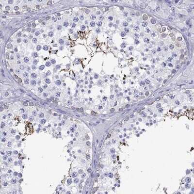 Immunohistochemistry-Paraffin: Melanocortin-5 R/MC5R Antibody [NBP2-14224]