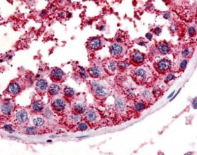 Immunohistochemistry-Paraffin: Melanocortin-5 R/MC5R Antibody - BSA Free [NLS1022]