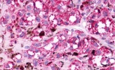 Immunohistochemistry-Paraffin: Melanocortin-5 R/MC5R Antibody - BSA Free [NLS1022]