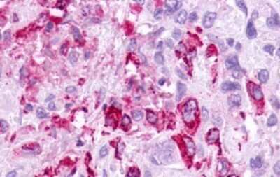 Immunohistochemistry-Paraffin: Melanocortin-5 R/MC5R Antibody - BSA Free [NLS1022]