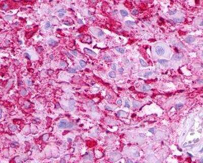 Immunohistochemistry-Paraffin: Melanocortin-5 R/MC5R Antibody - BSA Free [NLS1022]