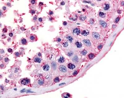 Immunohistochemistry-Paraffin: Melanocortin-5 R/MC5R Antibody - BSA Free [NLS1024]