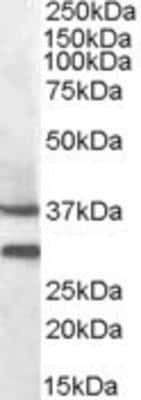 Western Blot: Melanocortin-5 R/MC5R Antibody [NBP1-36971]