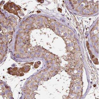 Immunohistochemistry: Melanoma Antigen Family B5 Antibody [NBP2-30617]