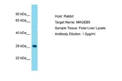 Western Blot: Melanoma Antigen Family B5 Antibody [NBP2-83193]