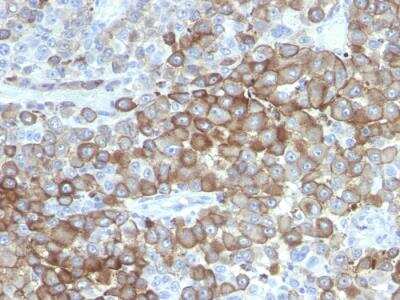 Immunohistochemistry-Paraffin: Melanoma Associated Antigen (PNL2) Antibody (PNL2) - IHC-Prediluted [NBP2-48231]