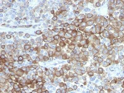Immunohistochemistry-Paraffin: Melanoma Associated Antigen (PNL2) Antibody (PNL2) [NBP2-45284]
