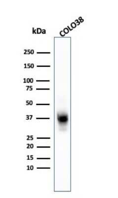 Western Blot: Melanoma Marker (MART-1 + Tyrosinase + gp100) Antibody (A103 + T311 + HMB45)Azide and BSA Free [NBP2-34547]