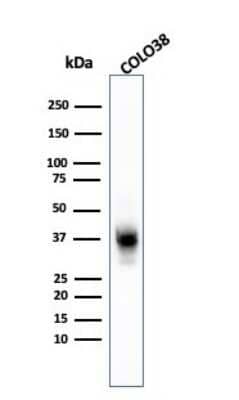 Western Blot: Melanoma Marker (MART-1 + Tyrosinase + gp100) Antibody (A103 + T311 + HMB45) [NBP2-34339]