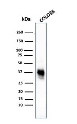 Western Blot: Melanoma Marker (MART-1 + Tyrosinase + gp100) Antibody (M2-7C10 + M2-9E3 + T311 + HMB45)Azide and BSA Free [NBP2-34681]